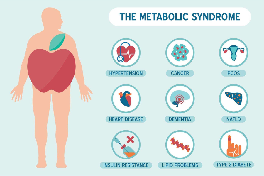 Metabolic Syndrome